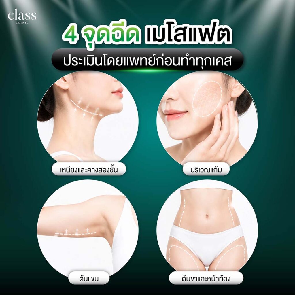 แฟตฉีดสลายไขมันจุดไหนได้บ้าง